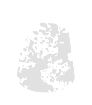 GW Citadel Technical Valhallan Blizzard 27-32